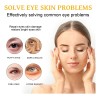 La Crema Reafirmante De Ojos Reduce Las Arrugas