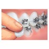 Genuine Orthowax - Dental Orthodontic Waxes (Pack of 100) Stick