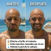 Zero Shine Spf Elimina El Brillo Y Protege Tu Cabeza