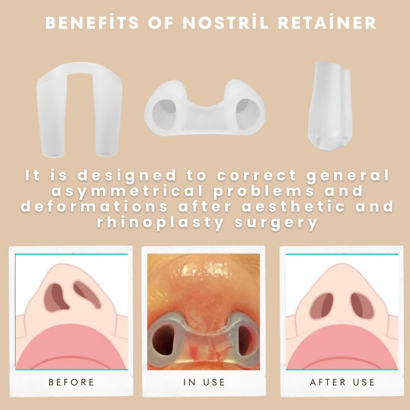 Nostril Retainer (2 Pack – Different Sizes) | Nose Splint