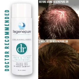 RegenePure DR Hair & Scalp Treatment 8 Oz Hair Loss Hair Regrowth, Brand New