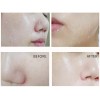 Anjo Professional Skin Soft Snail Peeling Gel