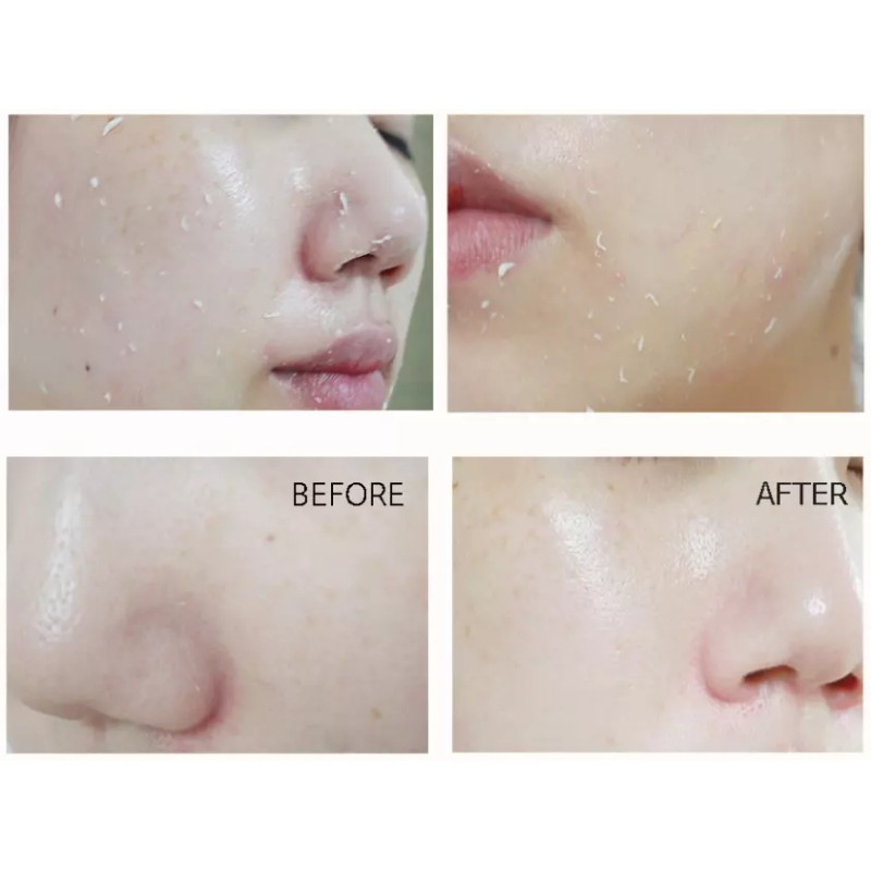 Anjo Professional Skin Soft Snail Peeling Gel