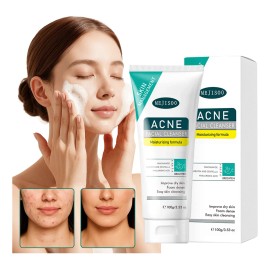 Limpieza Facial Anti-imperfecciones Con Ácido Salicílico