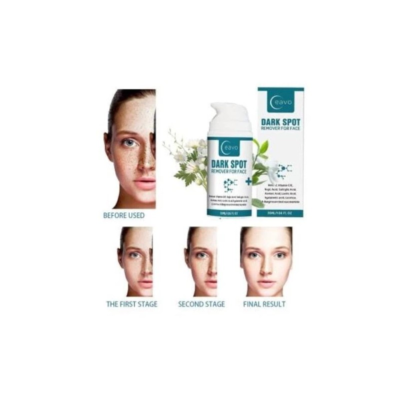 CEAVO DARK SPOT REMOVER FOR FACE 1.06 FL OZ