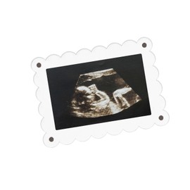 Tinoaly 2pcs Magnetic Acrylic Baby Picture Frames, 5x7in Transparent Scalloped Picture Frame for Display Pregnancy Announcement & Gender Reveal