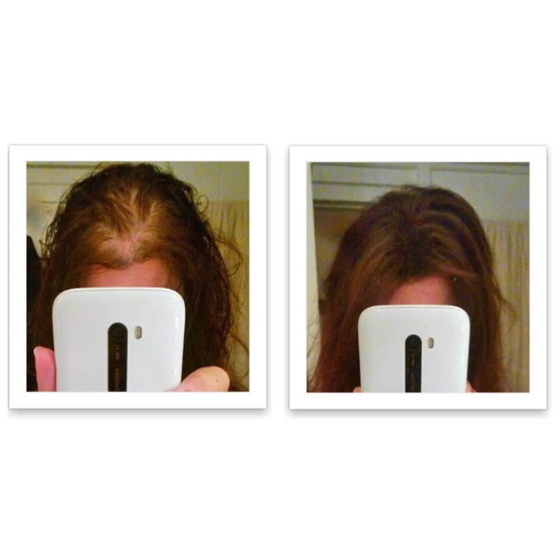 Caboki Hair Loss Concealer Trial Pack (Dark Brown)