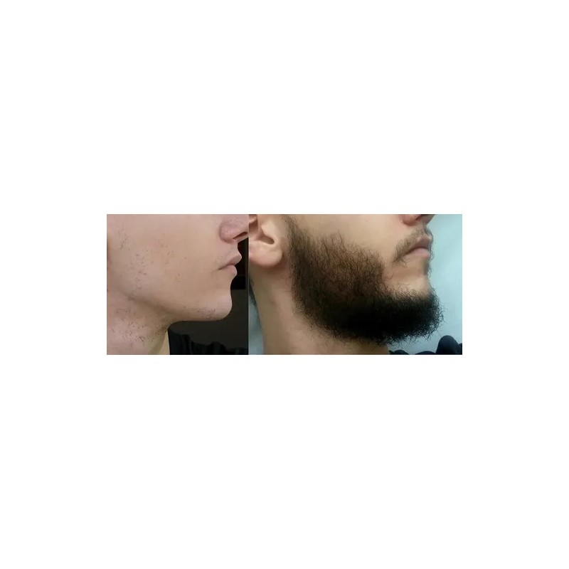 3pzas El Crecimiento De Barba Y Bigote Barbiux,crezca Machín