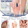 OQKAHIV 1 x Toe Splint Toe Straightening for Hammer Toe,