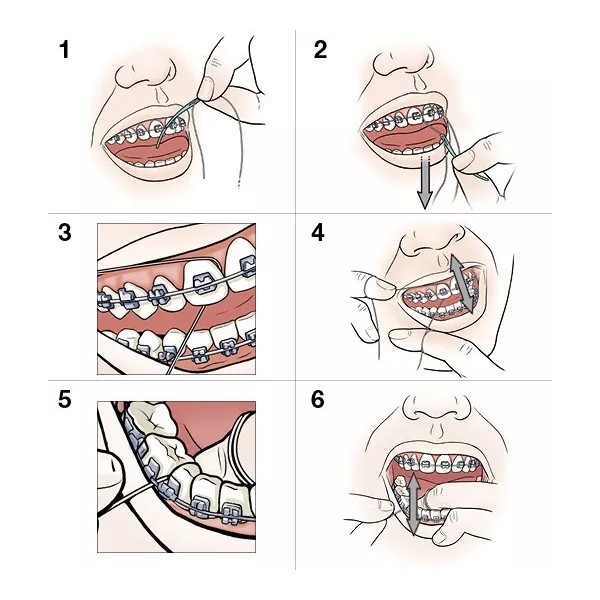 Oral-B Hilo Dental Para Brakets Ortodoncia ( 4 Cajas ) Oral B