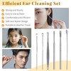 Ear Cleaner, The Most Professional Ear Cleaning Master in 2024—Earwax