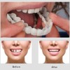 Snap-On Veneers - Professional DIY Smile Correction Kit for Men