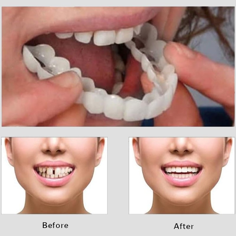 Snap-On Veneers - Professional DIY Smile Correction Kit for Men