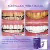 Sktto Kit Blanqueamiento Dental 14pzs Tiras Moradas
