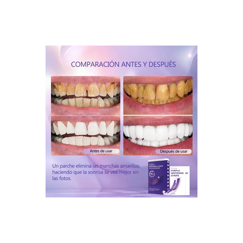 Sktto Kit Blanqueamiento Dental 14pzs Tiras Moradas