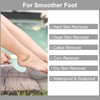Beomeen 3 Pack Nano Glass Foot File Callus Remover for