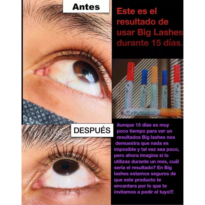 Big Lashes( Gel Para Crecimiento De Cejas Y Pestañas