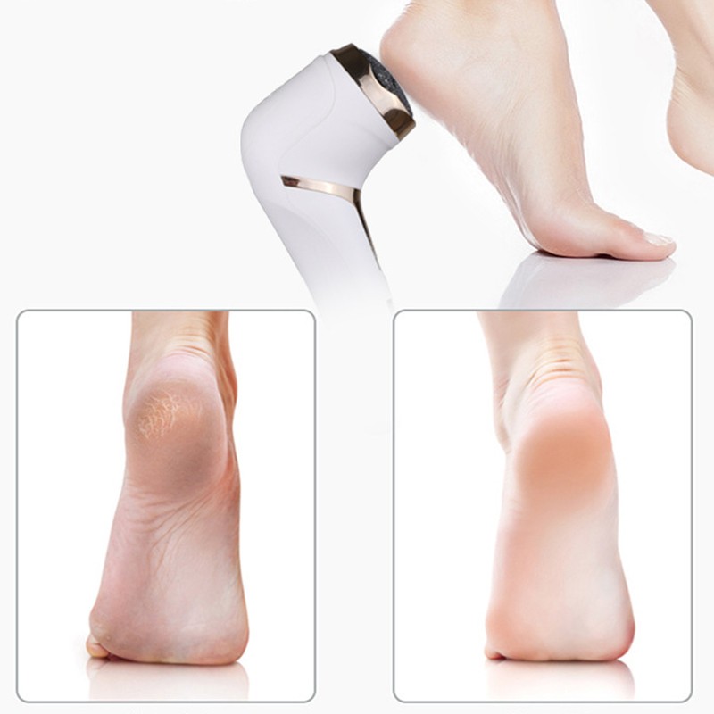 Electric Foot Callus Remover LCD Display Dead Skin Remover Foot