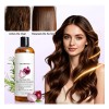 2pzs Shampoo Lexenic Excalvo Con Cebolla Y Aceite De Romer
