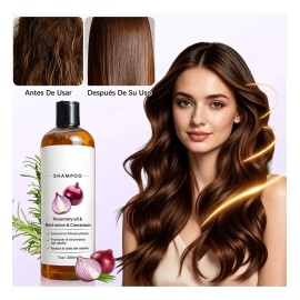 2pzs Shampoo Lexenic Excalvo Con Cebolla Y Aceite De Romer