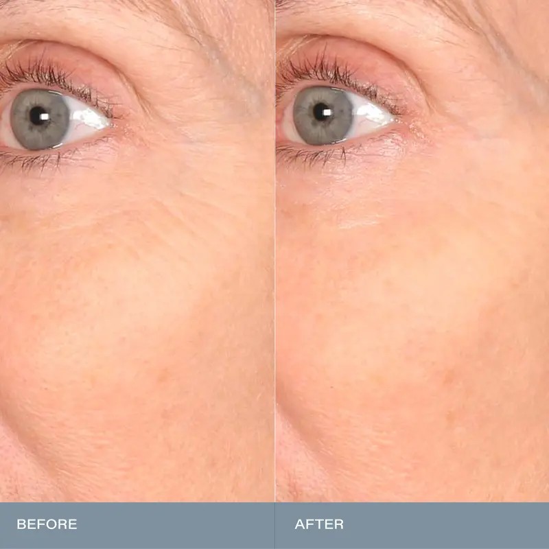SKINN Cosmetics Mantle Milk Skin Repair – 100 Hours of