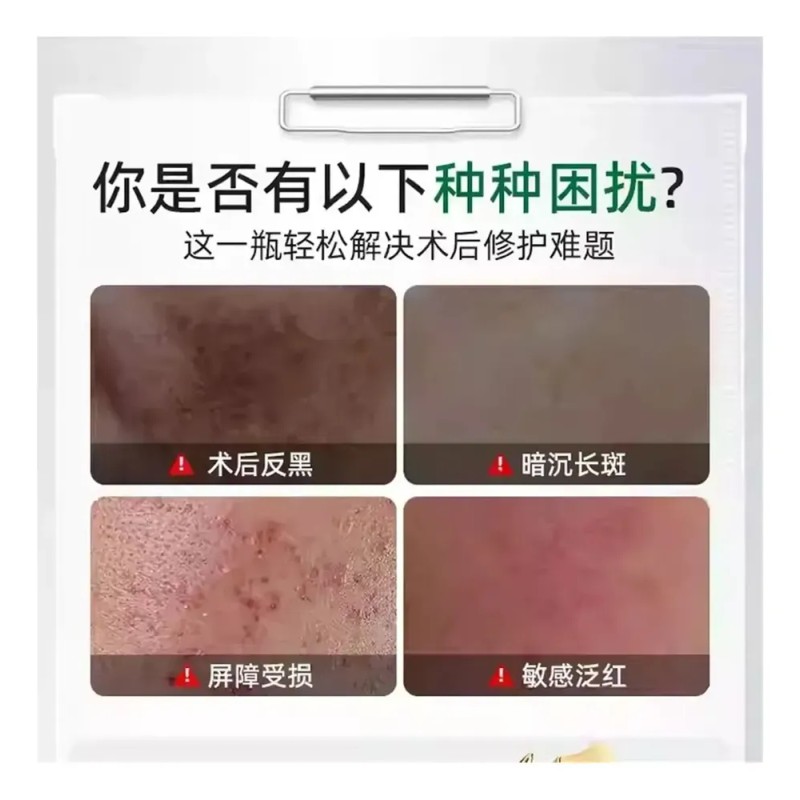 Crema Anti-manchas Con Ácido Tranexámico 30g - Aclara La Pie