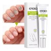 Compuesto completo para tratamiento de tiña Efero Nails, color blanco