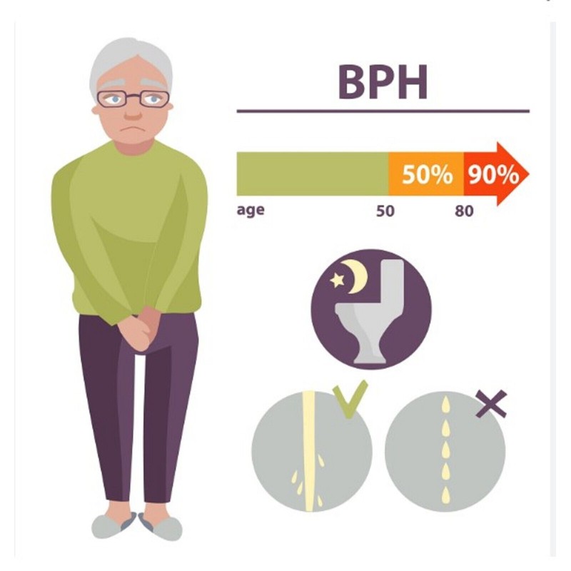 SUPPLEMENT4ME.COM NATURAL HELP FOR ENLARGED PROSTATE (BPH) - 100% HERBAL