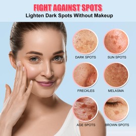 Dark Spot Corrector for Face and Body - Serum, Corrects Sun Spots, Freckles and Melasma - 1.7 Fl Oz