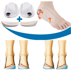 Mcvcoyh Plantillas ortopédicas para corregir insertos de zapatos de pierna tipo O/X, cojines magnéticos integrados para alineación de pies, dolor de rodilla y piernas de arco, 2 pares