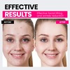 Hunvva Microcurrent Facial Device,Latest Red Light Technology,Enhances The Ability to
