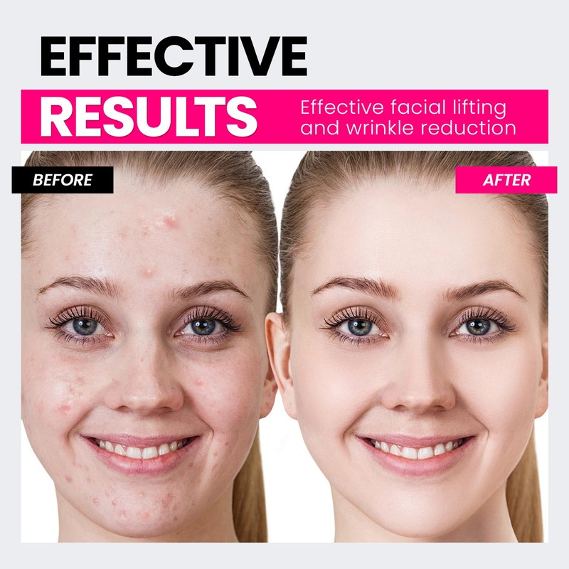 Hunvva Microcurrent Facial Device,Latest Red Light Technology,Enhances The Ability to