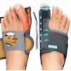 1 Pair Bunion Corrector Big Toe Straightener With 2 Angle