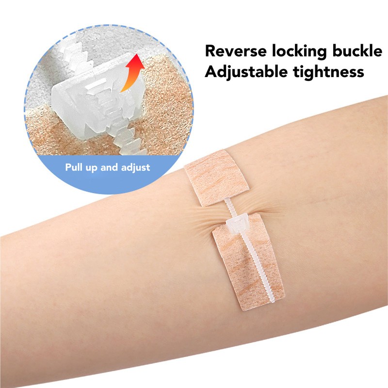 3 Pcs Wound Closure Strip Stitchless Self Adhesive Non Woven