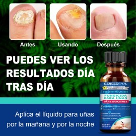 Líquido Antibacteriano De Uñas Grises Uñas Enfermas 30ml