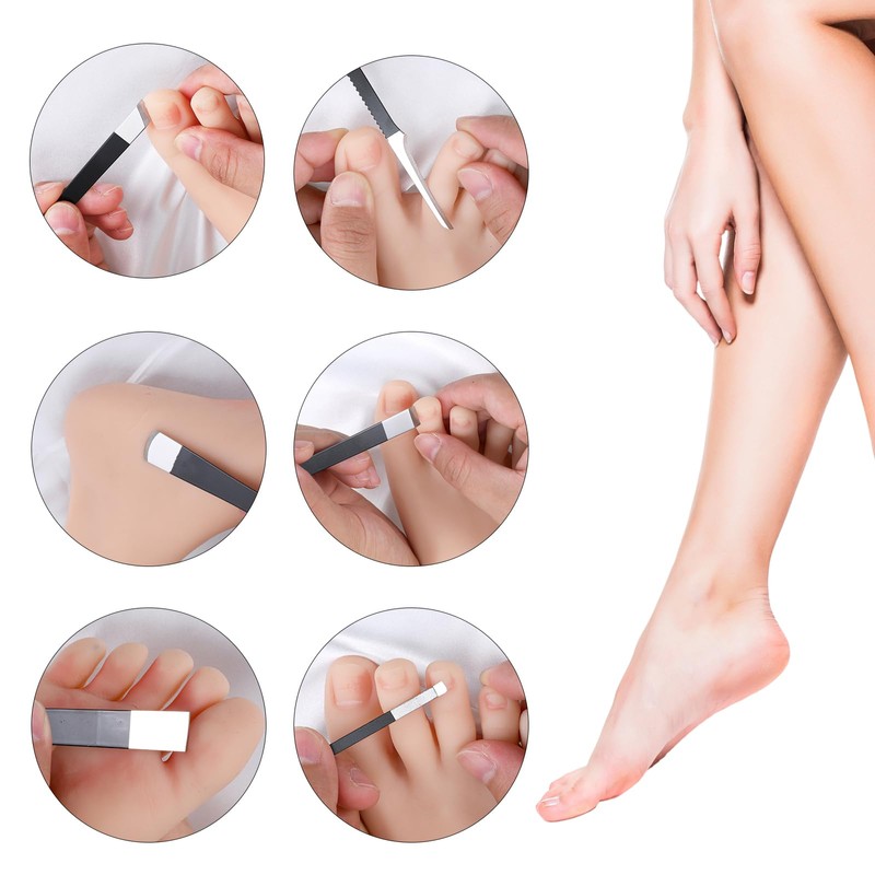 MBAIYO 6 Pack Ingrown Toenail Removal Kit, Professional Pedicure Tools