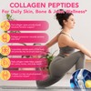 Multi Collagen Peptides Powder 16oz, Unflavored Hydrolyzed Collagen Types I,