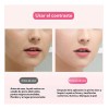 Ultrasónico Exfoliación Limpiador Cuidar Piel,skin Scrubber