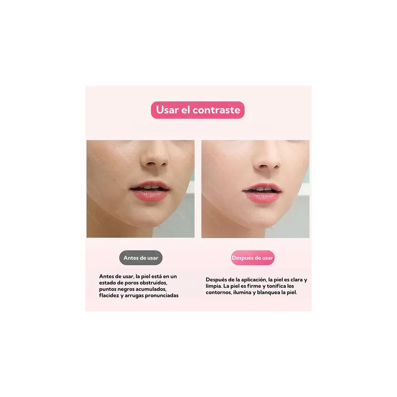 Ultrasónico Exfoliación Limpiador Cuidar Piel,skin Scrubber