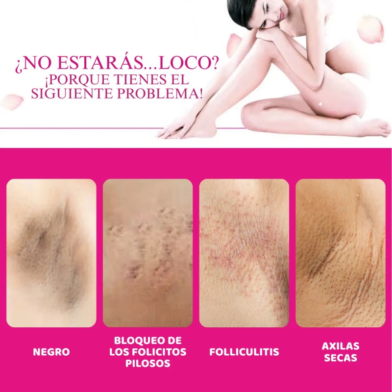 Crema Aclaradora Yogurt Zona Íntima Pezón Manchas Codo Full