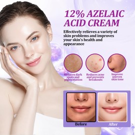 WANJAO Azelaic Acid 12% Cream, Facial Skin Care Products with Niacinamide - Vitamin C Serum & Salicylic Acid for Reduce fine lines, moisturize, 20g x 2