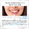 Kyogoku Crystal Whitening Gel, Medicated Toothpaste, Whitening Teeth, Supervised by