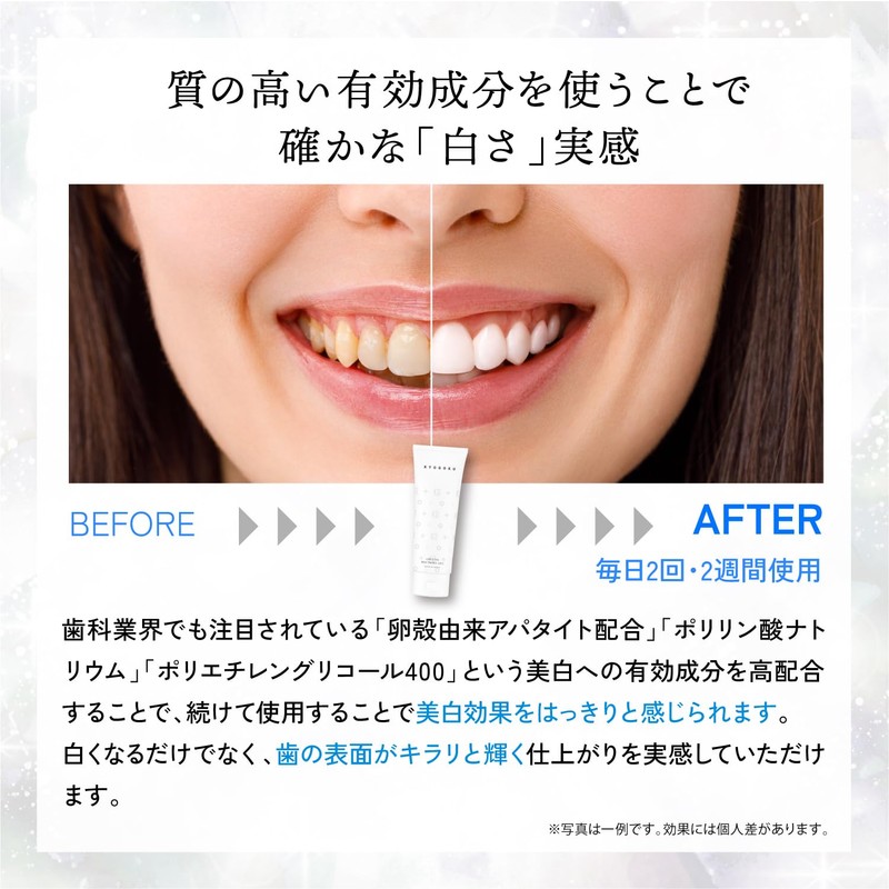 Kyogoku Crystal Whitening Gel, Medicated Toothpaste, Whitening Teeth, Supervised by