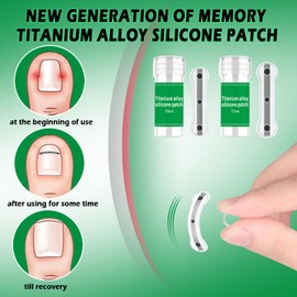 Titanium Alloy Silicone Ingrown Toenail Treatment, Designed for Curved Nail Repair, Ingrown Toenail Corrector, Nail correction tool, Ingrown Toenail Removal Kit,Suitable for Any Toenail Size men woman