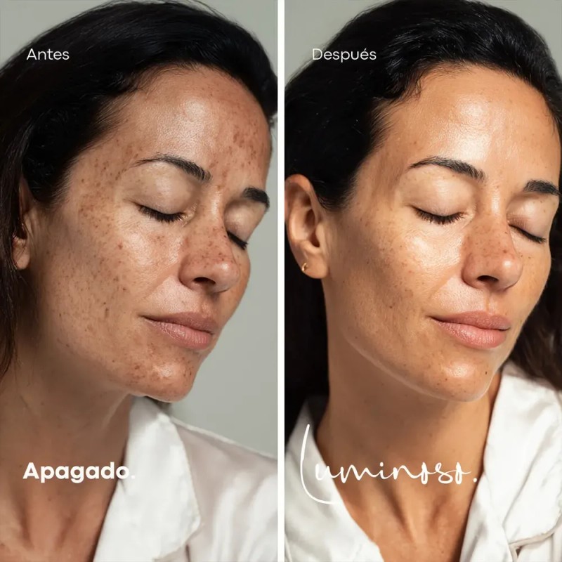 Crema Facial Despigmentante Meladermic Day con FPS20 para Manchas y