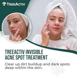 TreeActiv- Tratamiento invisible para el acné quístico con ácido salicílico para el rostro, fórmula original, 0,5 fl oz, crema facial para el acné