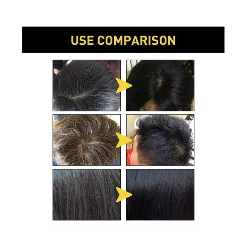 KFMX Shampoo Instantaneo Para Teñir Crecimiento Capilar Cabello