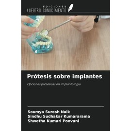 Prótesis sobre implantes: Opciones protésicas en implantología