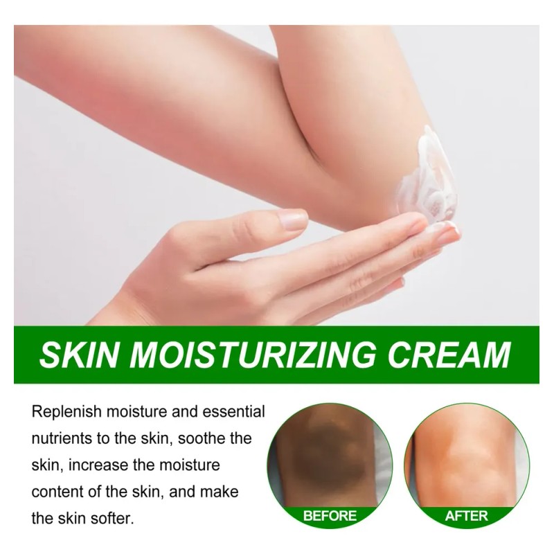 Crema Corporal Aclaradora De Piel Eelhoe Para Codos Y Axilas