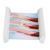 Lipoprotein LDL Blood Vessel Model Low Density Blood Lipid Vessel